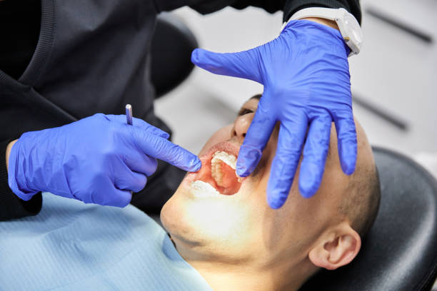 Best Emergency Root Canal Therapy in Phillipsburg, GA