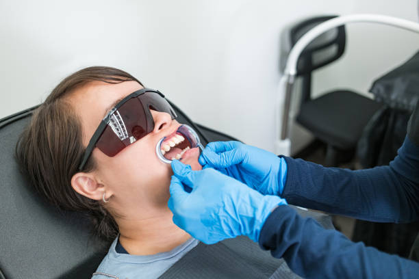 Best Knocked-Out Tooth (Avulsed Tooth) Treatment in Phillipsburg, GA